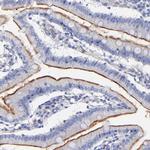 SLC44A2 Antibody in Immunohistochemistry (Paraffin) (IHC (P))