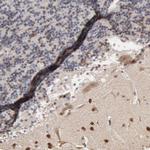 CHM Antibody in Immunohistochemistry (Paraffin) (IHC (P))