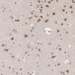 CHM Antibody in Immunohistochemistry (Paraffin) (IHC (P))