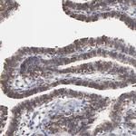 CHM Antibody in Immunohistochemistry (Paraffin) (IHC (P))