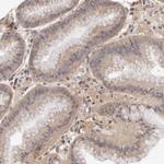 PCMT1 Antibody in Immunohistochemistry (Paraffin) (IHC (P))