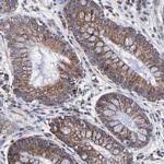 ZNF550 Antibody in Immunohistochemistry (Paraffin) (IHC (P))