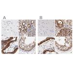 CD2AP Antibody in Immunohistochemistry (IHC)