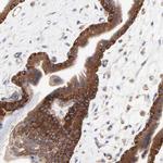 CD2AP Antibody in Immunohistochemistry (IHC)