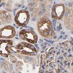 CD2AP Antibody in Immunohistochemistry (IHC)