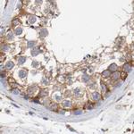 CD2AP Antibody in Immunohistochemistry (IHC)