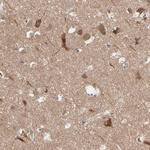 Optineurin Antibody in Immunohistochemistry (IHC)