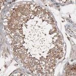 Optineurin Antibody in Immunohistochemistry (IHC)