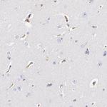 CD2AP Antibody in Immunohistochemistry (IHC)