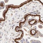 CD2AP Antibody in Immunohistochemistry (IHC)