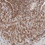 UBE2L6 Antibody in Immunohistochemistry (Paraffin) (IHC (P))