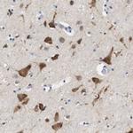 UBE2G2 Antibody in Immunohistochemistry (Paraffin) (IHC (P))