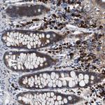 UBE2G2 Antibody in Immunohistochemistry (Paraffin) (IHC (P))