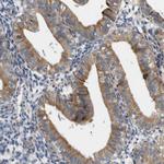 UBE2G2 Antibody in Immunohistochemistry (Paraffin) (IHC (P))