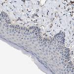 UBE2G2 Antibody in Immunohistochemistry (Paraffin) (IHC (P))