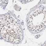 SMARCA1 Antibody in Immunohistochemistry (Paraffin) (IHC (P))