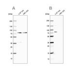 Optineurin Antibody in Western Blot (WB)