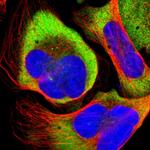 RPLP1 Antibody in Immunocytochemistry (ICC/IF)