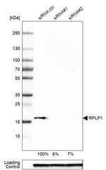 RPLP1 Antibody