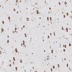 RPLP1 Antibody in Immunohistochemistry (IHC)