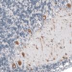 RPLP1 Antibody in Immunohistochemistry (IHC)