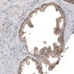 RPLP1 Antibody in Immunohistochemistry (IHC)