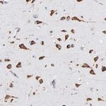 RPL9 Antibody in Immunohistochemistry (IHC)