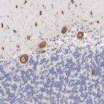 RPL9 Antibody in Immunohistochemistry (IHC)