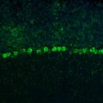 RPL9 Antibody in Immunohistochemistry (IHC)