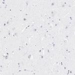 LTBP2 Antibody in Immunohistochemistry (Paraffin) (IHC (P))