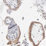 LTBP2 Antibody in Immunohistochemistry (Paraffin) (IHC (P))