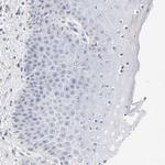 LTBP2 Antibody in Immunohistochemistry (Paraffin) (IHC (P))