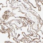 LTBP2 Antibody in Immunohistochemistry (IHC)