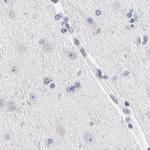 Nesprin 2 Antibody in Immunohistochemistry (IHC)