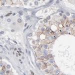 Nesprin 2 Antibody in Immunohistochemistry (IHC)