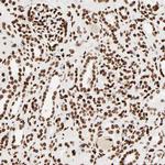 HMGB2 Antibody in Immunohistochemistry (Paraffin) (IHC (P))