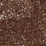 HMGB2 Antibody in Immunohistochemistry (Paraffin) (IHC (P))