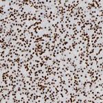 HMGB2 Antibody in Immunohistochemistry (Paraffin) (IHC (P))