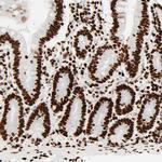 HMGB2 Antibody in Immunohistochemistry (Paraffin) (IHC (P))