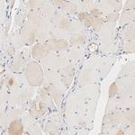 UBE2J1 Antibody in Immunohistochemistry (Paraffin) (IHC (P))