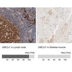 UBE2J1 Antibody in Immunohistochemistry (IHC)