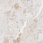 UBE2J1 Antibody in Immunohistochemistry (IHC)