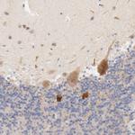 MTERFD3 Antibody in Immunohistochemistry (Paraffin) (IHC (P))