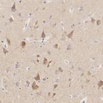 MTERFD3 Antibody in Immunohistochemistry (Paraffin) (IHC (P))