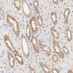 MTERFD3 Antibody in Immunohistochemistry (Paraffin) (IHC (P))