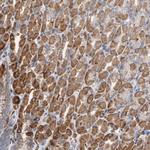 OXA1L Antibody in Immunohistochemistry (Paraffin) (IHC (P))