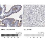 Adenylate Kinase 7 Antibody in Immunohistochemistry (IHC)