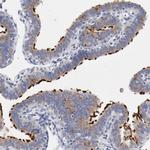 Adenylate Kinase 7 Antibody in Immunohistochemistry (IHC)