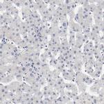 Adenylate Kinase 7 Antibody in Immunohistochemistry (IHC)