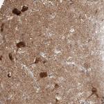 Amisyn Antibody in Immunohistochemistry (IHC)